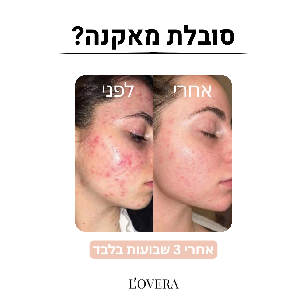 ציפית משי לעור הפנים