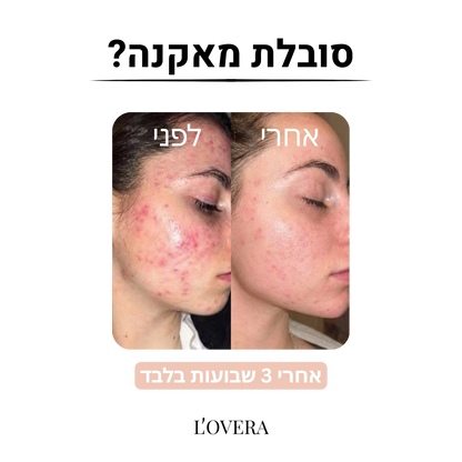 ציפית משי לעור הפנים