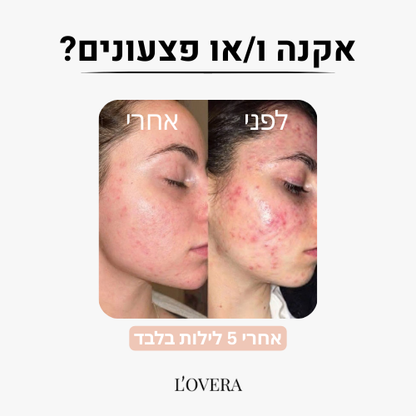 ציפית משי פרימיום